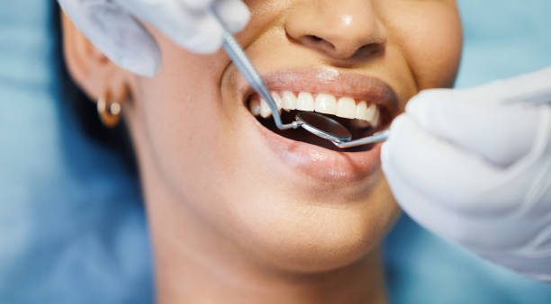 Best Emergency Wisdom Teeth Removal in Beulaville, NC