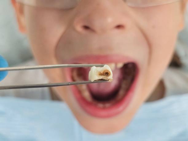 Best Emergency Broken Tooth Repair in Beulaville, NC
